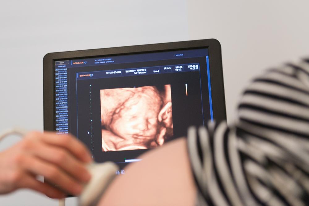 🤰🏼 Szülésfelkészítő konzultáció 🌸